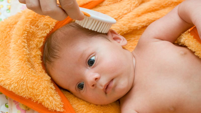Cara Membersihkan Kerak Di Kepala Bayi